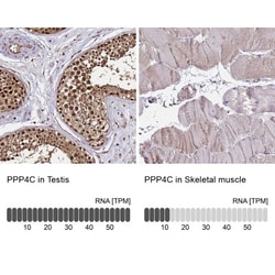 PP4/PPP4C Antibody, Novus Biologicals 0.1mL; Unlabeled:Antibodies, Polyclonal